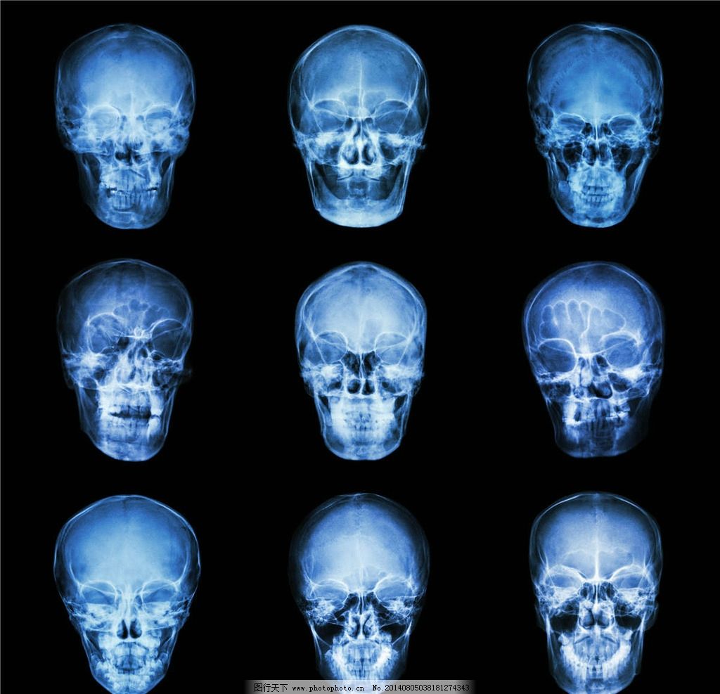 迄今最完整最高清人脑的7T磁共振成像，比临床头部图像详细1000倍_凤凰网视频_凤凰网