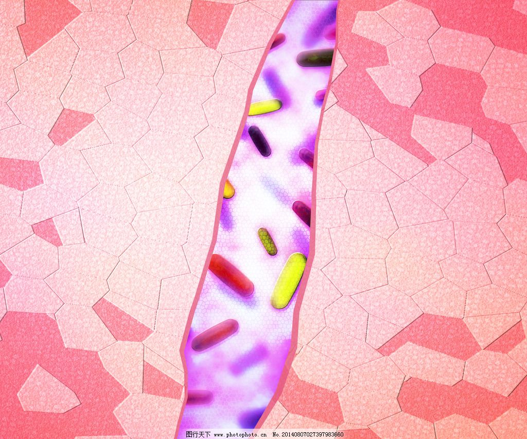 这种伤口算开放性伤口吗?